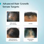 Buy Pilgrim 3% Redensyl, 4% Anagain & 5% Capilia Stem Cell Complex Advanced Hair Growth Serum Roll-On - 25 ml - Purplle