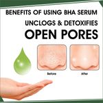 Buy UrbanYog Nose Strips Black / Whitehead Remover + BHA Serum To Treat Pores - 4 Strips - Purplle