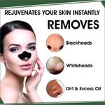 Buy UrbanYog Nose Strips Black / Whitehead Remover + BHA Serum To Treat Pores - 4 Strips - Purplle