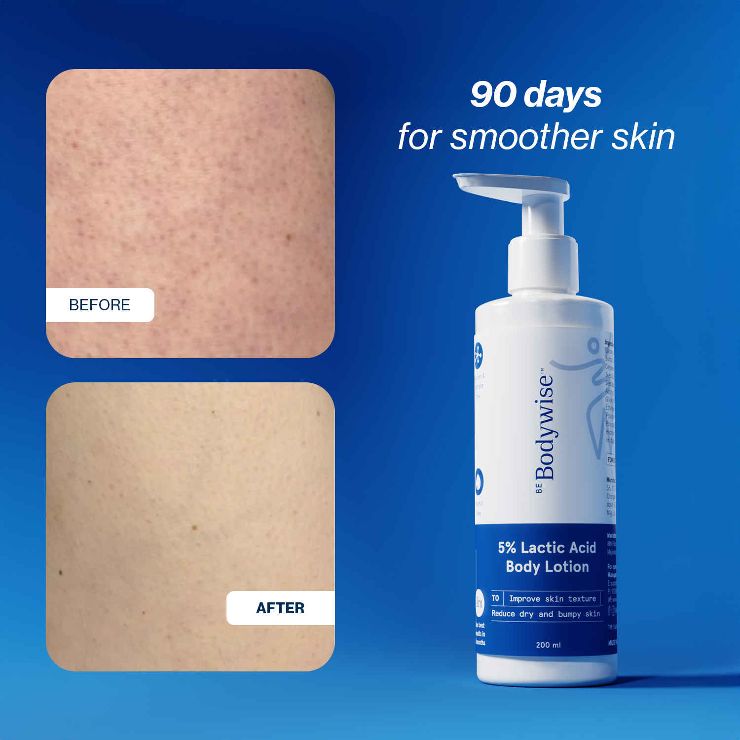 Buy Be Bodywise 5% Lactic Acid Body Lotion - 200 ml - Purplle