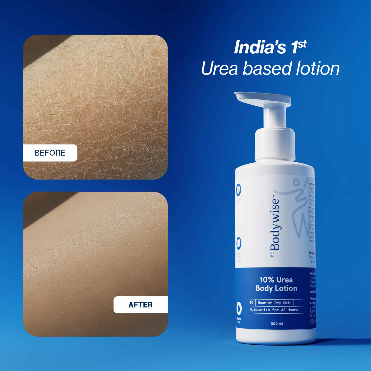 Buy Be Bodywise 10% Urea Body Lotion - 300 ml - Purplle