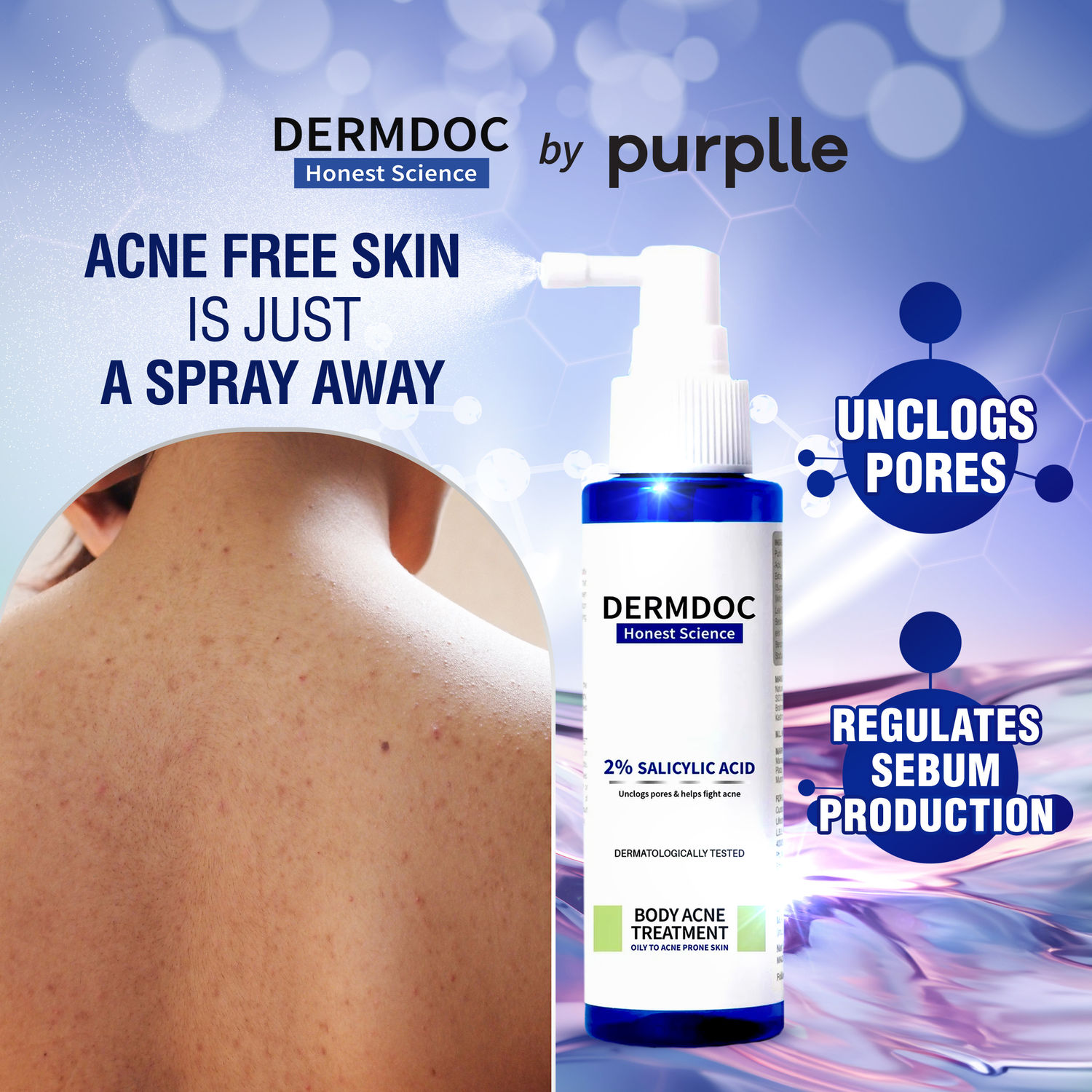 Buy DERMDOC by Purplle 2% Salicylic Acid Body Acne Treatment Spray (100ml) | Acne Treatment | Body Acne Spray | Body Acne Spray | Body Acne Treatment - Purplle
