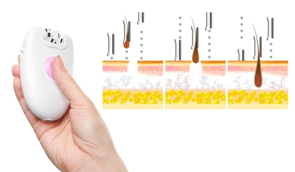 Details more than 75 best epilator for pubic hair super hot in.eteachers