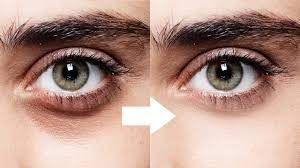 Clears dark undereye circles -  benefits of ghee