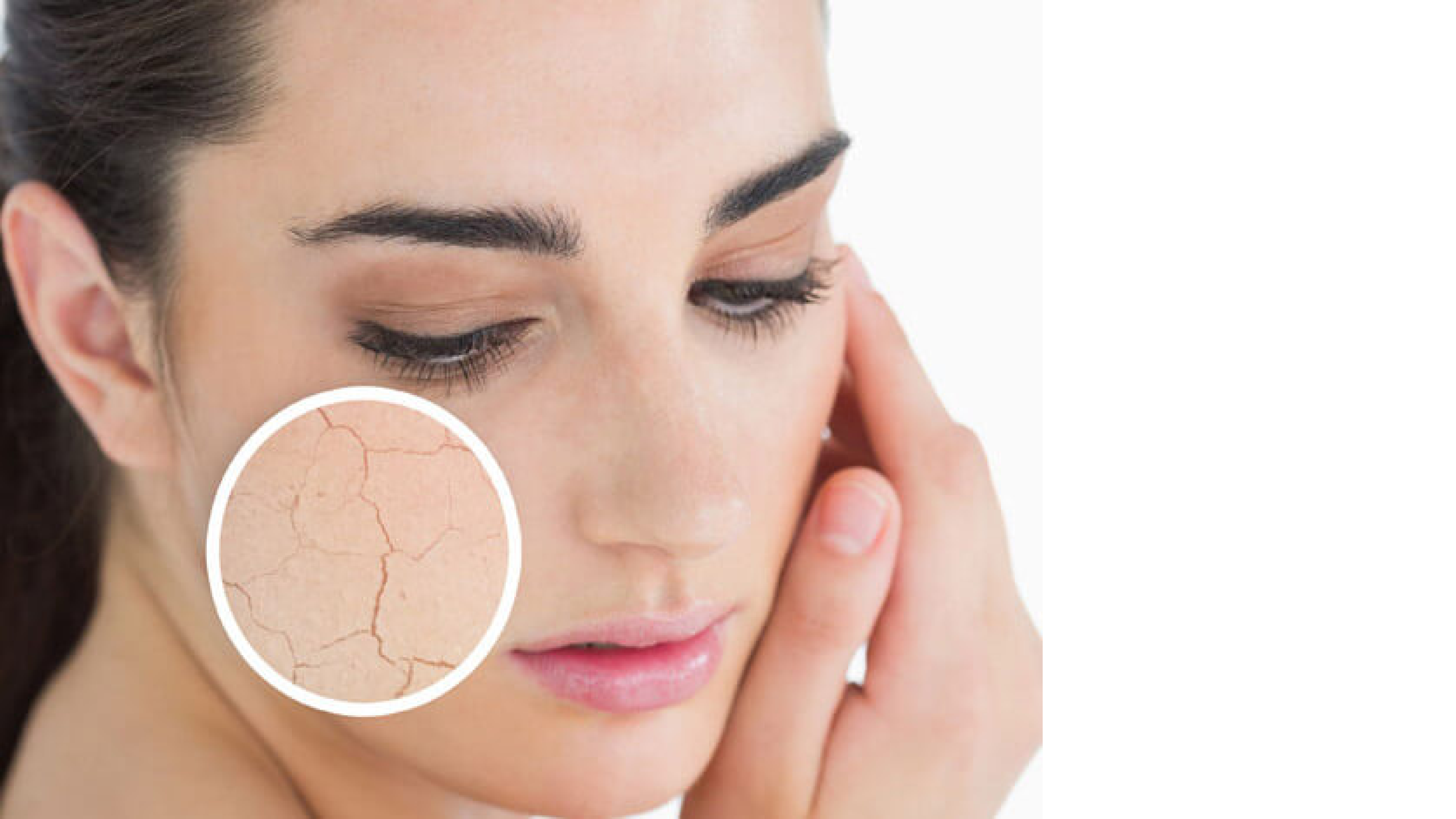 Dangerous Beauty Treatment Leaves Users With Scaly Skin - 5ff09sp