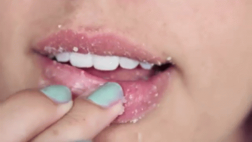 How To Heal Chapped Lips - 5 | Skin | Purplle