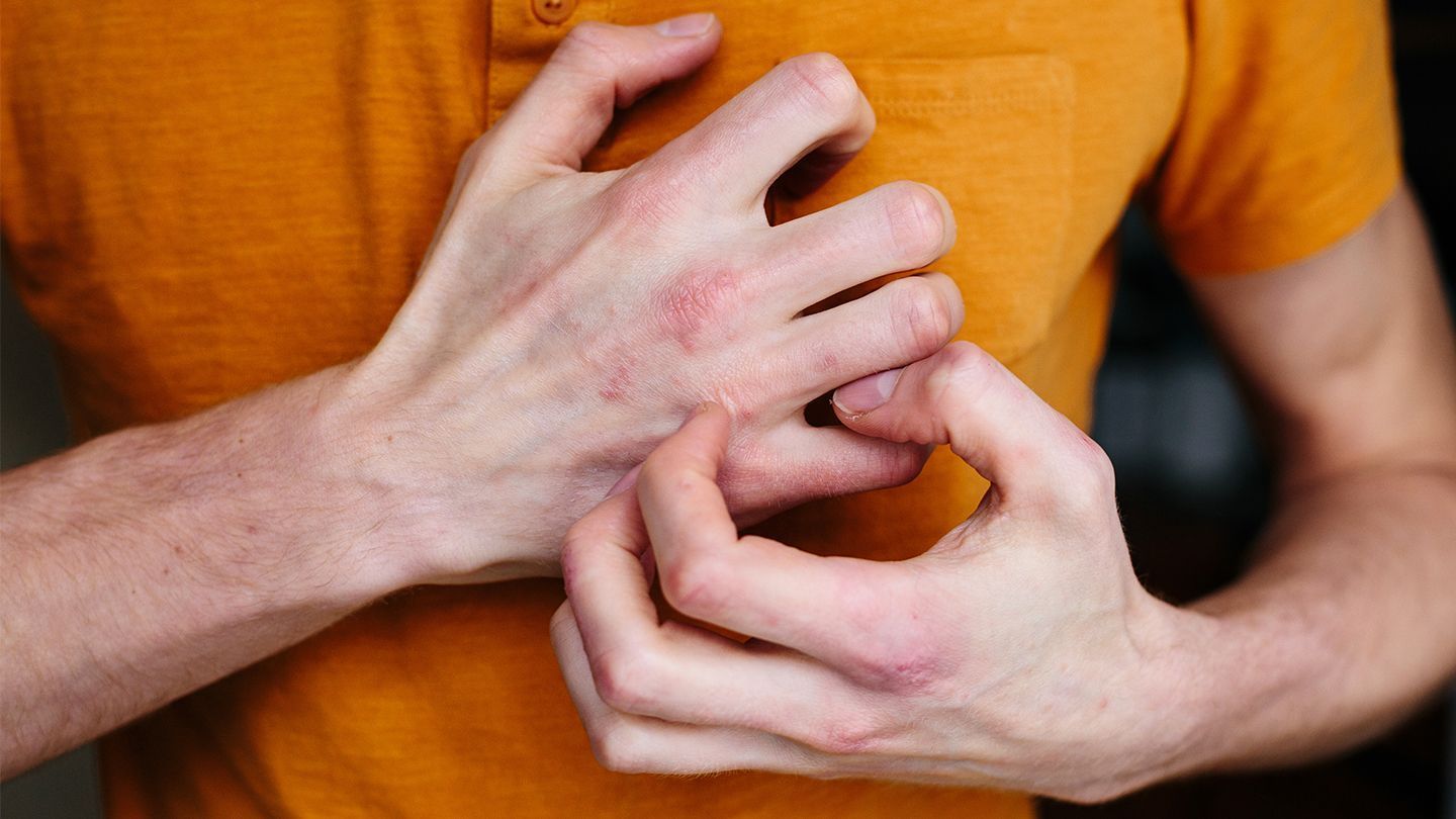Hand Cream Protection against Infections