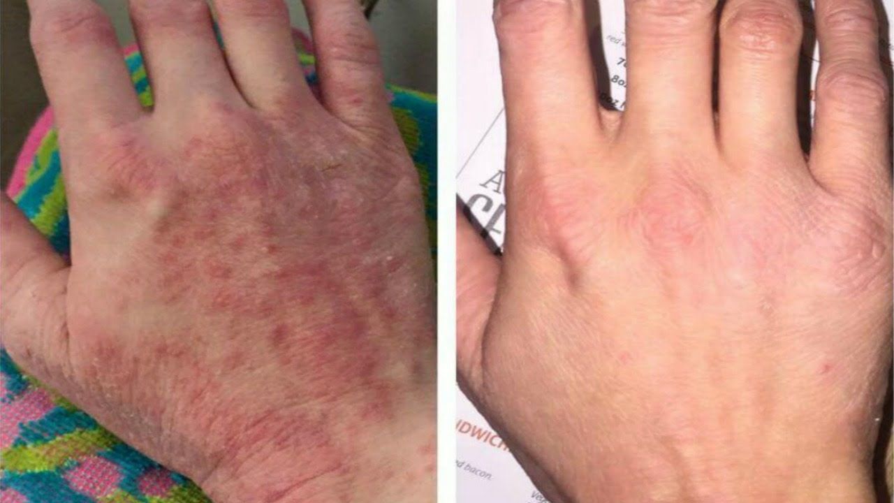 Hand Cream Repair Damaged Skin