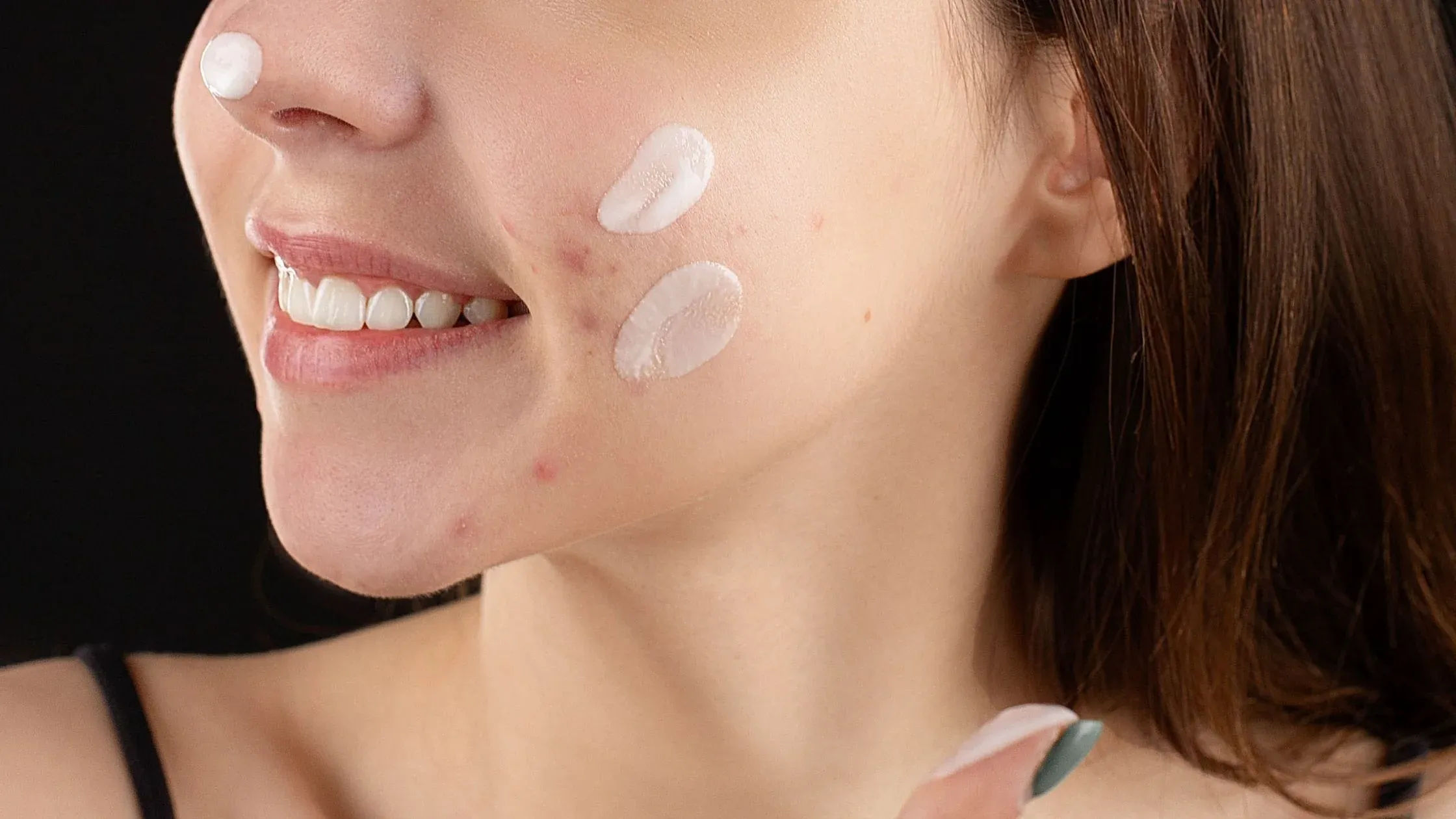 Niacinamide: 4 Benefits for Skin and Usage Tips for Topical Use