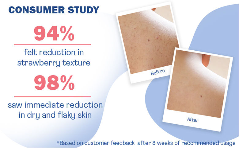 WishCare 10% AHA + 1% BHA Body Lotion - Smooths Rough & Bumpy Skin ...