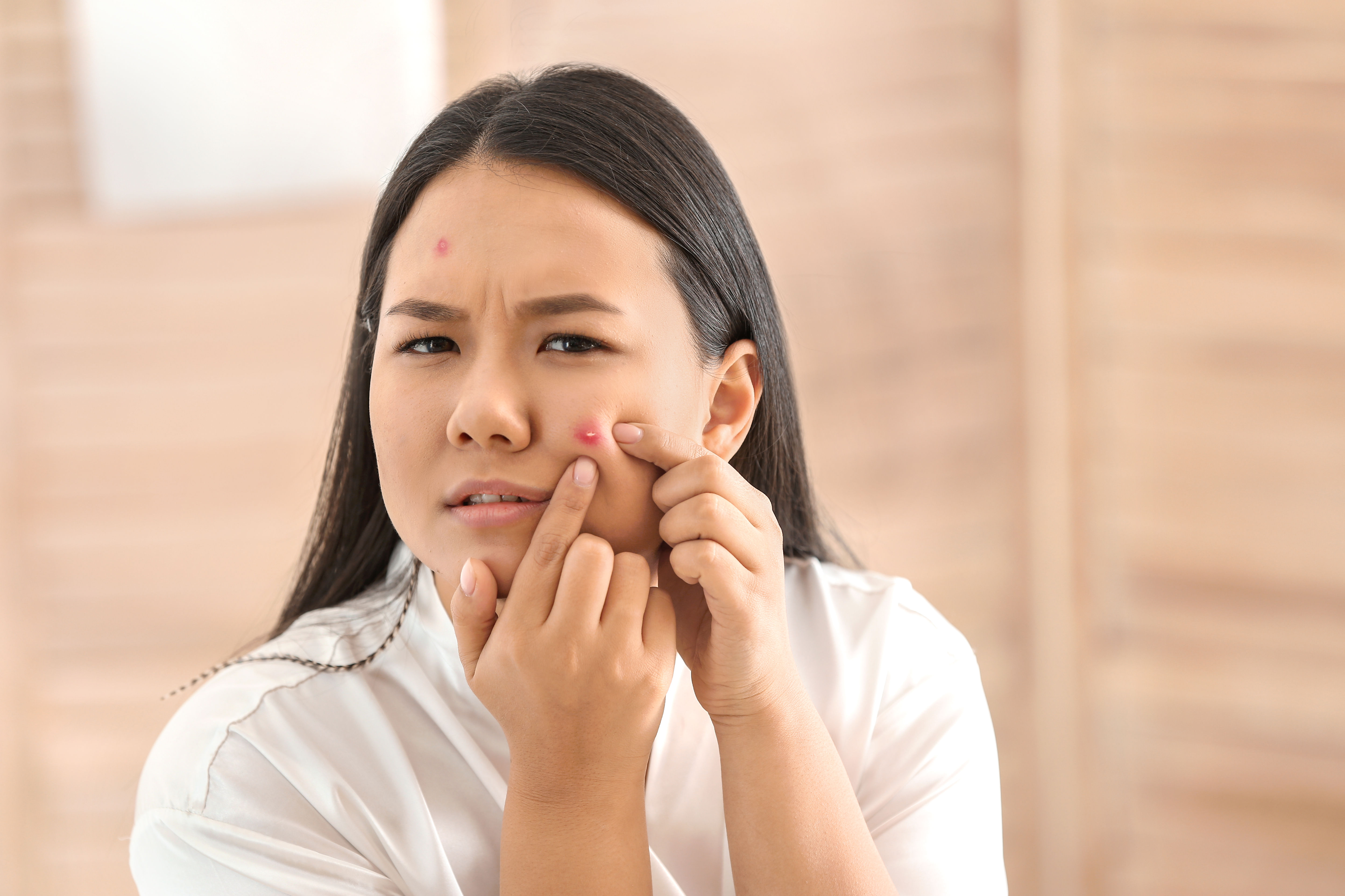 Pesky pimples no-more!