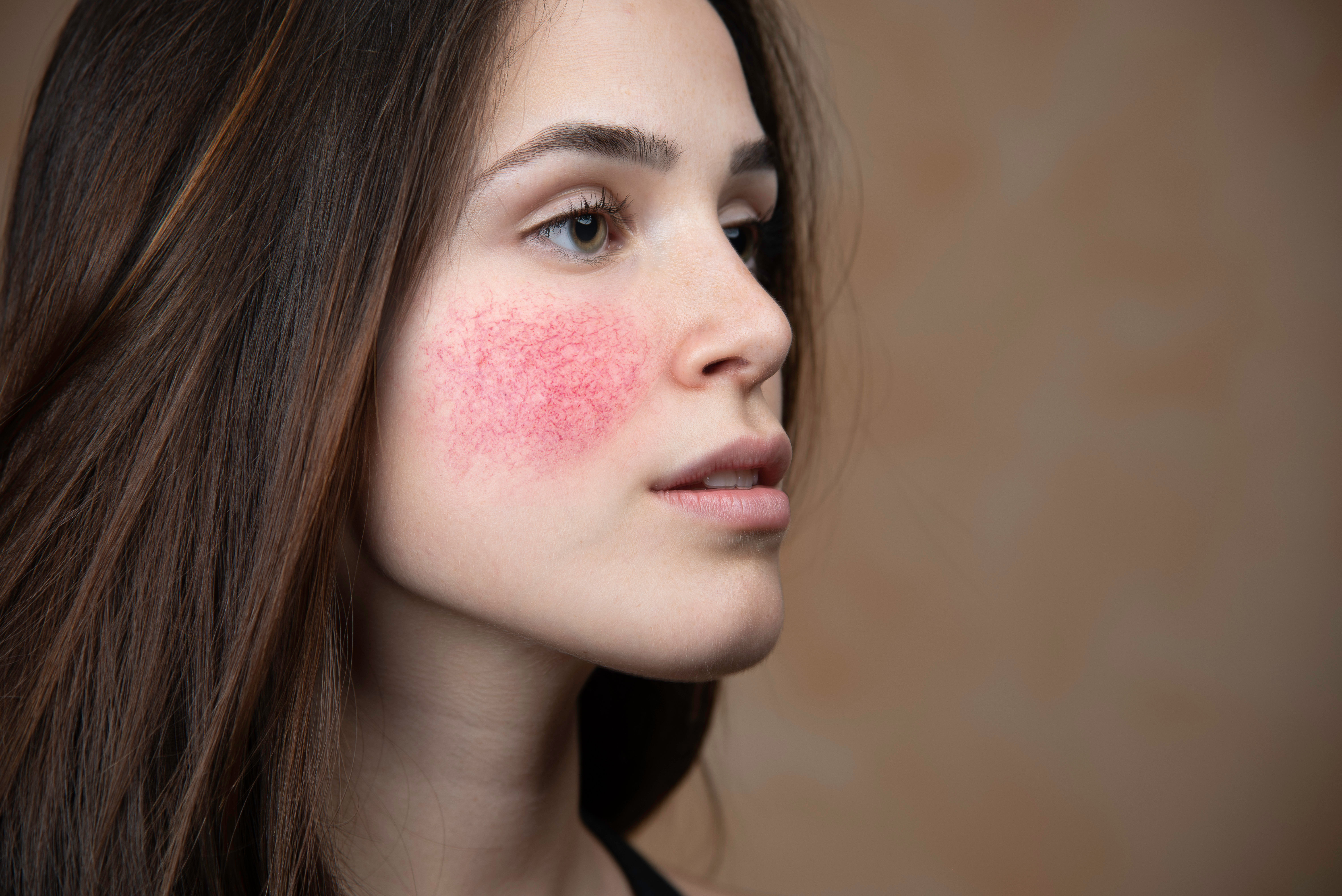 Reduces redness
