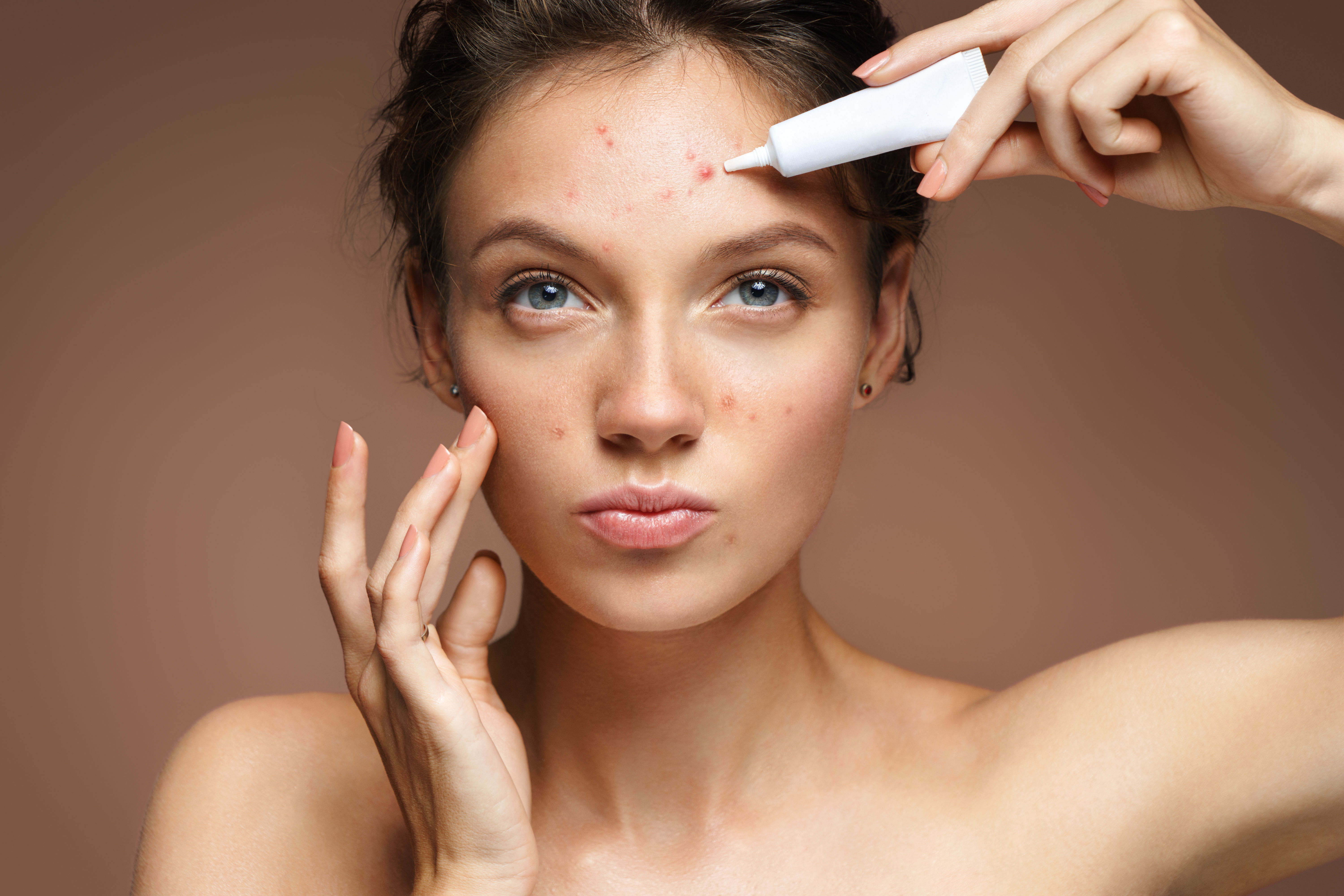 Apply your acne spot treatment and cream to treat pimples.