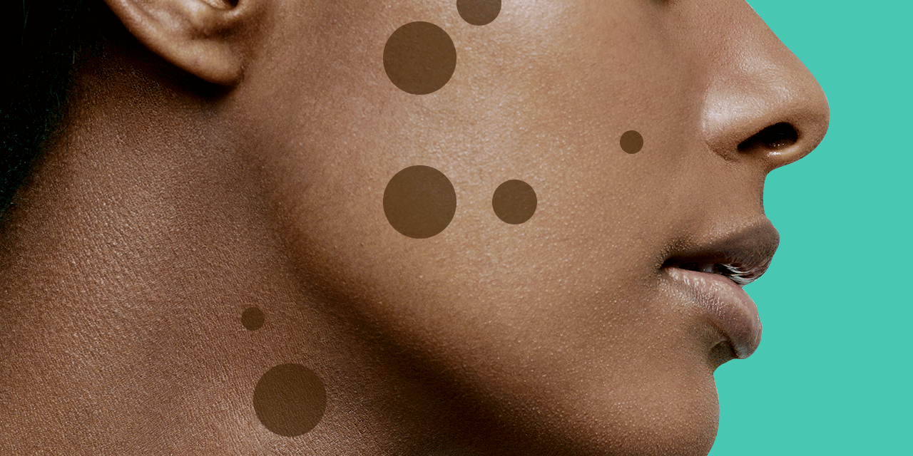 Benefits Of Vitamin E: Fades Dark spot