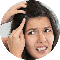 Inflamed Scalp