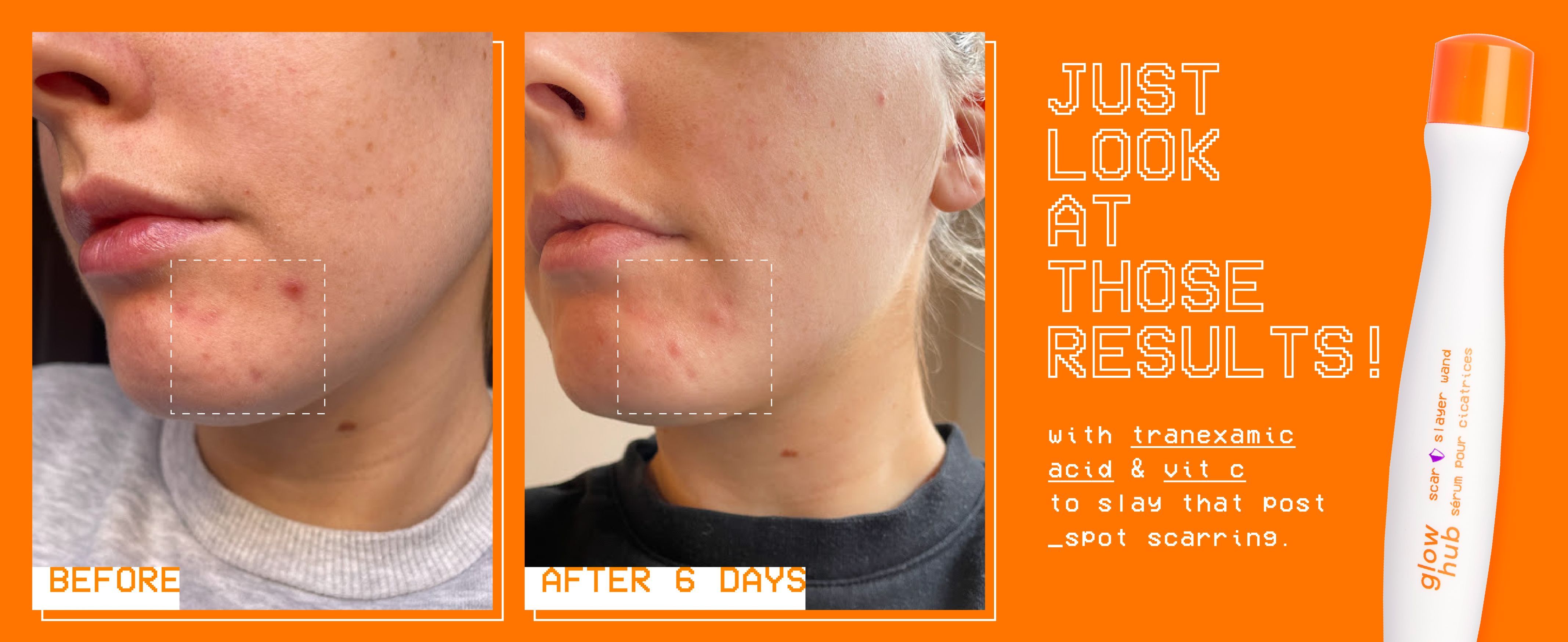 Glow Hub Scar Slayer Wand