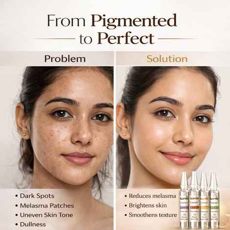 Buy Sanfe PigmentReset 5 Day Melasma Cure Kit – Targeted Brightening Ampoules with Kojic, Niacinamide, Glutathione, Vitamin C & Alpha Arbutin for Dark Spots, Uneven Skin Tone & Radiant Complexion (25 ml) - Purplle