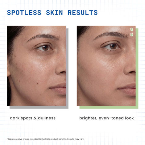 brightening serum- kojic acid & glutathione product info and reviews EQQUALBERRY Vitamin Illuminating Serum | Niacinamide 4% TXA | Vitamin C Serum for Face Glow with Hyaluronic | Dark Spot & Uneven Tone Care Korean Skin Care Ultra Brightening