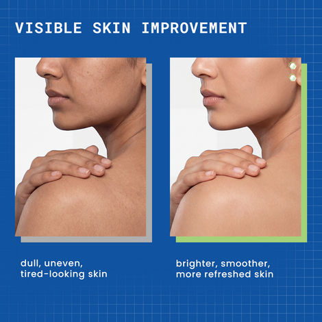 glutathione vs kojic acid which is better DERMDOC 2% Kojic Acid and 0.5% Glutathione Cleansing Bar