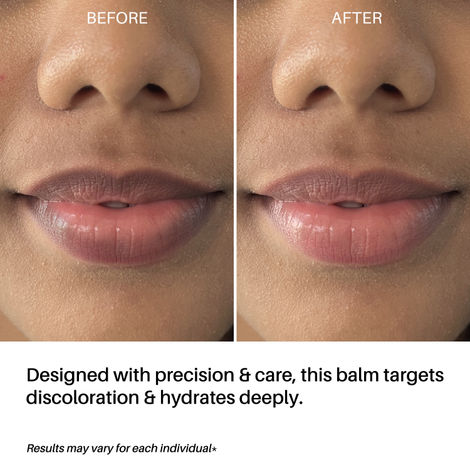 glutathione for lips DERMDOC LipBright Treatment 1% Glutathione + 2.5% Arbutin Lip Lightening  Balm (10 ml)