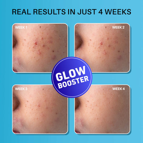 les bienfaits du glutathione Glutathion : un antioxydant puissant pour une peau saine les bienfaits du glutathione Glutathion : un antioxydant puissant pour une peau saine