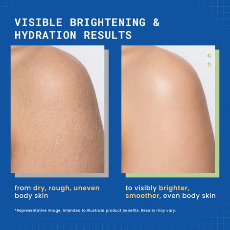 hyaluronic acid vs glutathione DERMDOC 1% Hyaluronic Acid & Glutathione Hya-Bright Moisturising Body  Lotion 180 ml