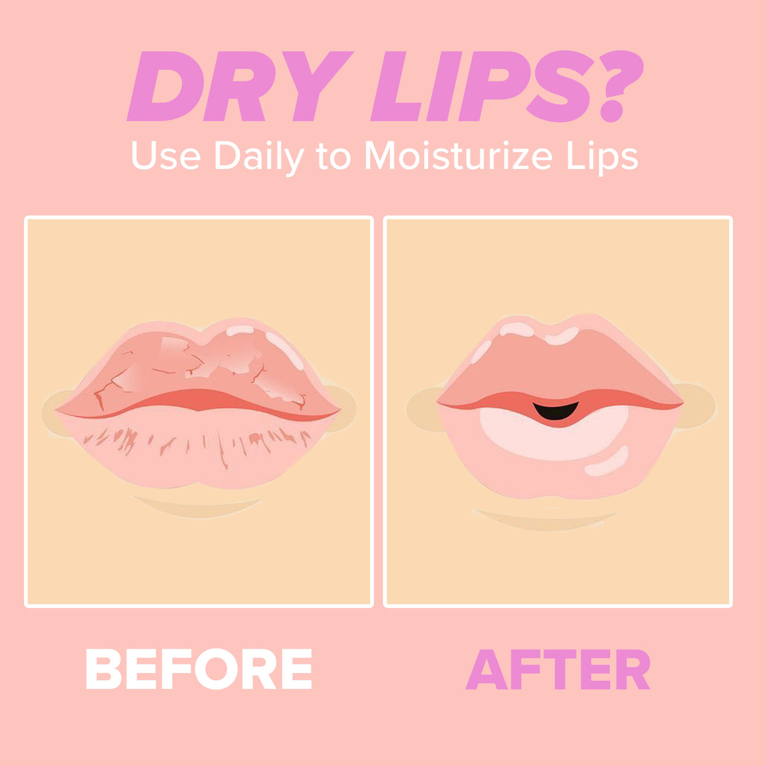 I DEW CARE PLUSH PARTY, Vitamin C Lip Mask I DEW CARE PLUSH PARTY, Vitamin C Lip Mask