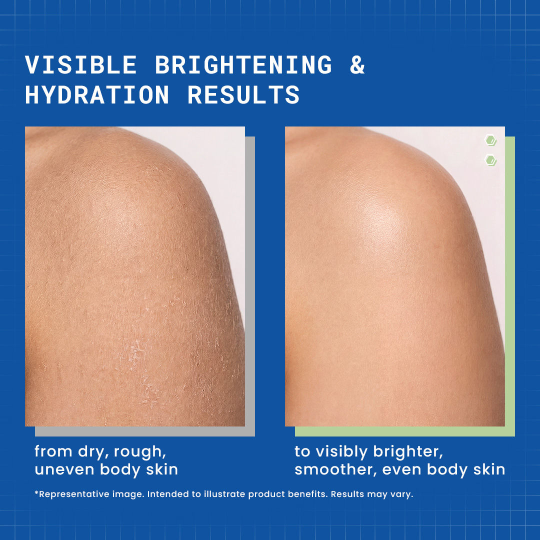 glutathione body scrub before and after results DERMDOC 1% Hyaluronic Acid & Hya-Bright Moisturising Lotion 180 ml كريم تفتيح آثار الحبوب Volume:800 ml Phentermine Side Effects, Results