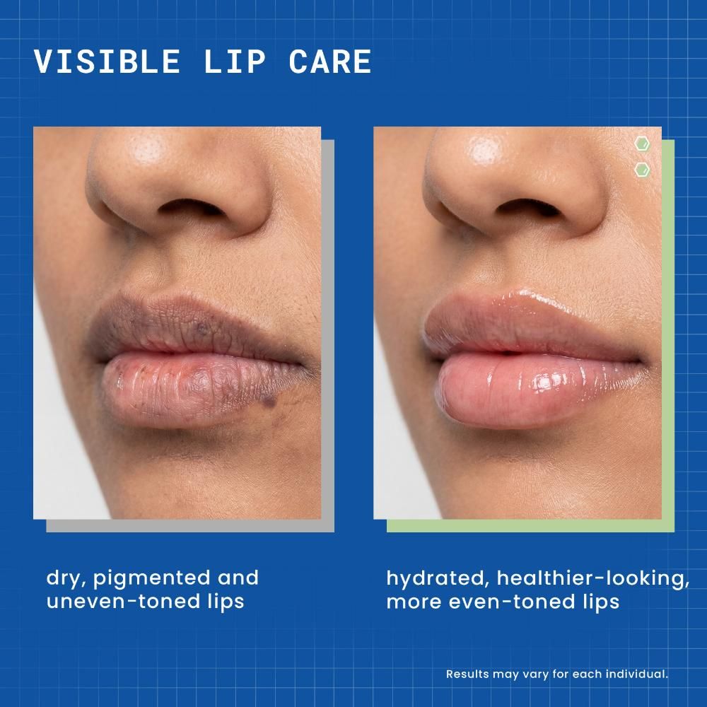 glutathione lip lightening balm DERMDOC LipBright Treatment 1% Glutathione + 2.5% Arbutin Lip Lightening  Balm (10 gm)