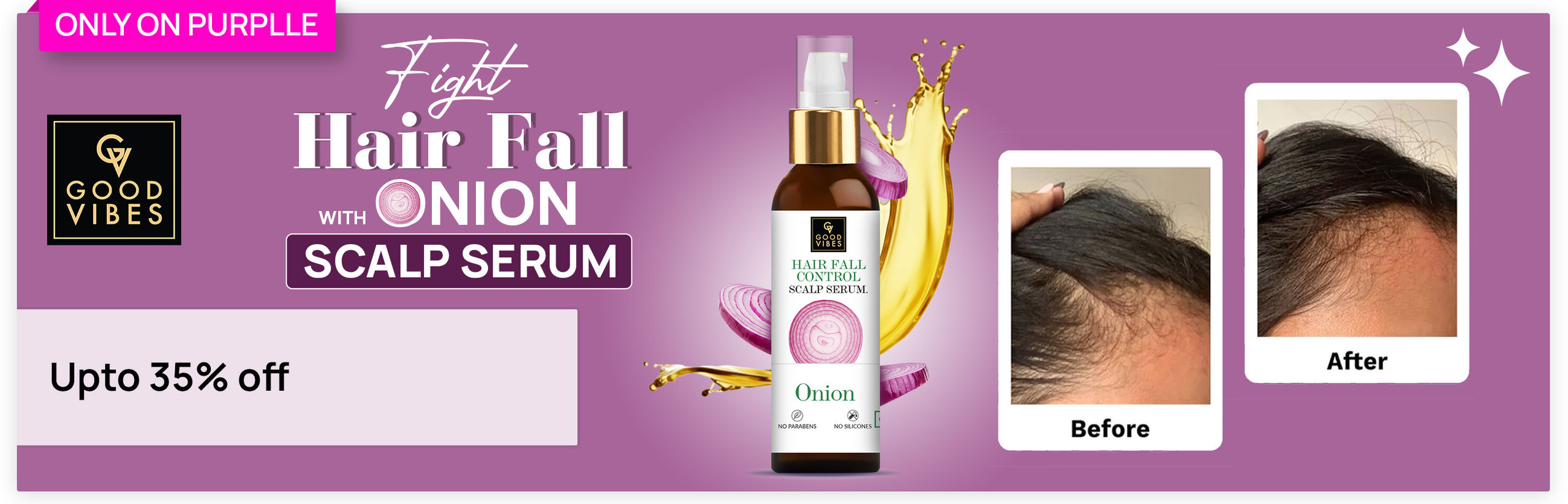 https://media6.ppl-media.com/tr:w-1280,c-at_max,pr-true,dpr-2/mediafiles/ecomm/misc/1711018931_gv-onion-hair-serum-banner_web_-2.jpg